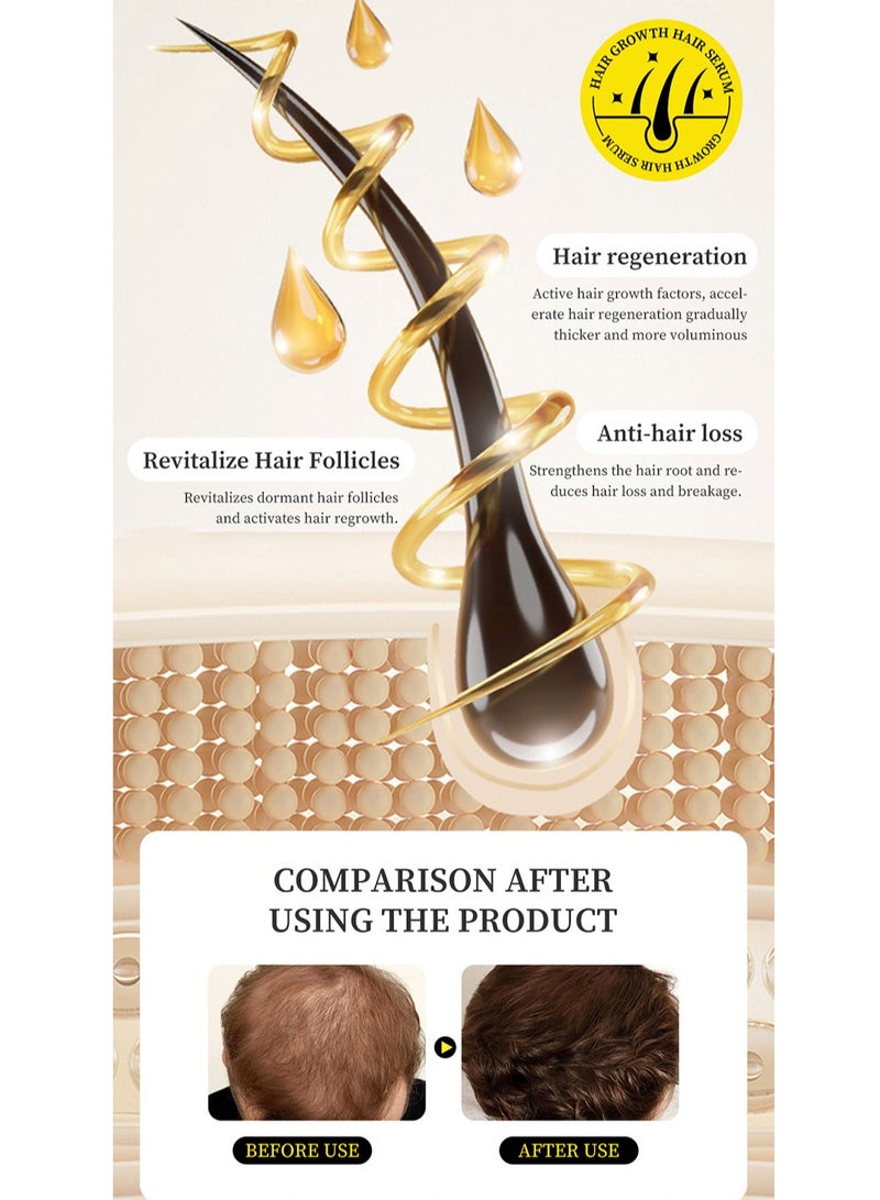 مويكا جوهر نمو الشعر جوهر مغذي ومغذي للشعر 30 مل - Image 5