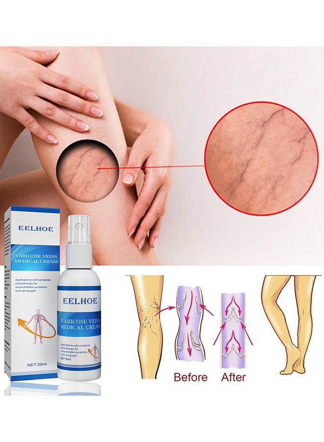 EELHOE Varicose Veins Medical Cream, Eliminate And Spider Veins Spray, Varicose Veins Relief, Improve Blood Circulation, Soothes Tired Legs, Antiedema, Improve Blood Circulatio Quickly Soothing Swelling 30ML  - Image 5