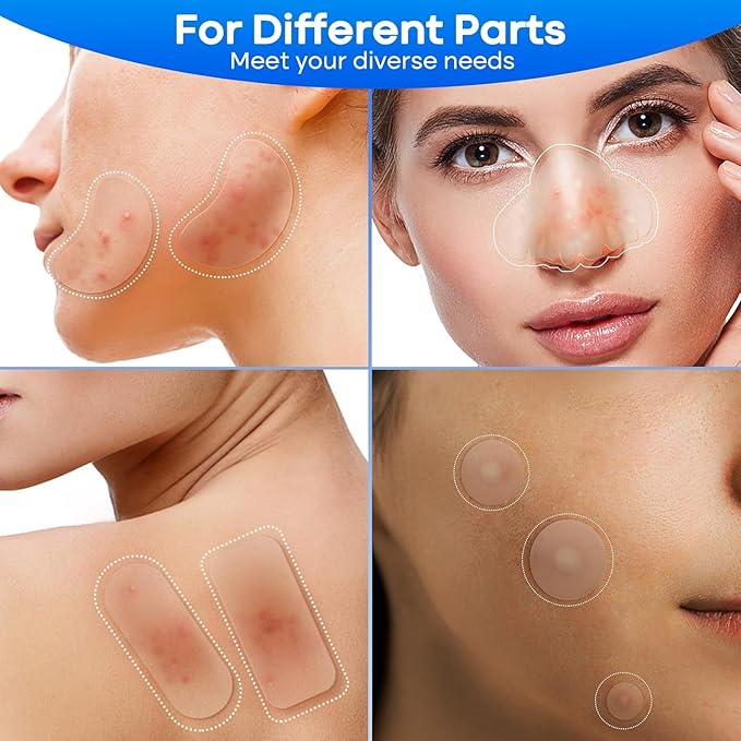 Flywind Large Pimple Patches331 Patches 7 size Acne Patches Invisible Spot Patches for Face Chin Back or BodyHydrocolloid Pimple Patch Suitable for All Skin Types - Image 4