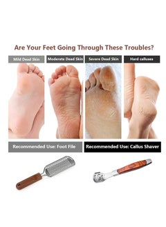 Vusoset Colossal Foot Rasp & Wood Handle Callus Shaver (10 Replacement & 1 Foot File Heads), Pedicure Foot File Kit, Heel Scraper For Feet, Foot File Callus Remover  - Image 5