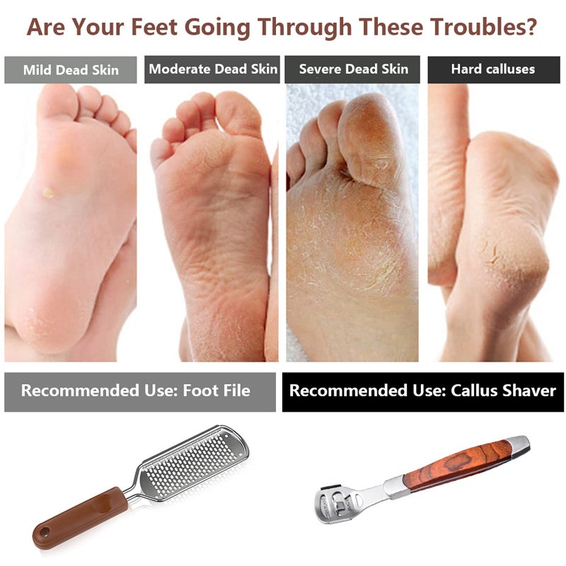 Vusoset Colossal Foot Rasp & Wood Handle Callus Shaver (10 Replacement & 1 File Foot Heads), Pedicure Foot File Kit, Heel Scraper for Feet, Foot File Callus Remover - Image 5