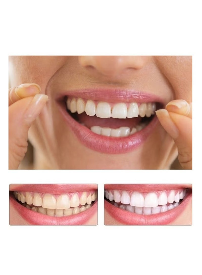Generic Teeth Veneers, Smile Instant, Temporary Tooth Kit Decoration, Perfect Braces, Whitening Alternative, No Pain Fix Smile  - Image 5