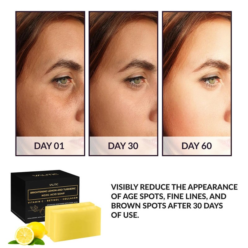 VALITIC Brightening Lemon & Turmeric Kojic Acid Soap with Vitamin C, Retinol, Collagen - Original Japanese Complex Infused with Hyaluronic Acid, Vitamin E, Shea Butter, Castile Olive Oil (2 Pack) - Image 3