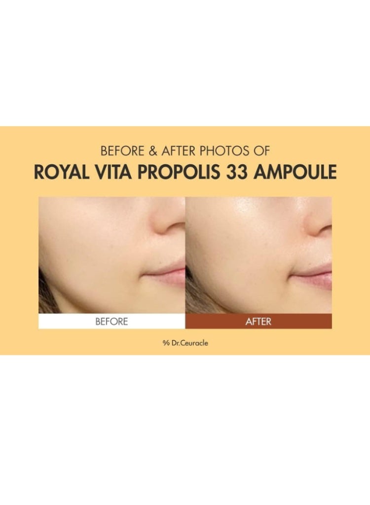 علاج البشرة الباهتة والجافة والمتعبة – Dr.Ceuracle Royal Vita Propolis 33 Ampoule لإشراقة فورية، ترطيب عميق وشد البشرة (30ml) - Image 4