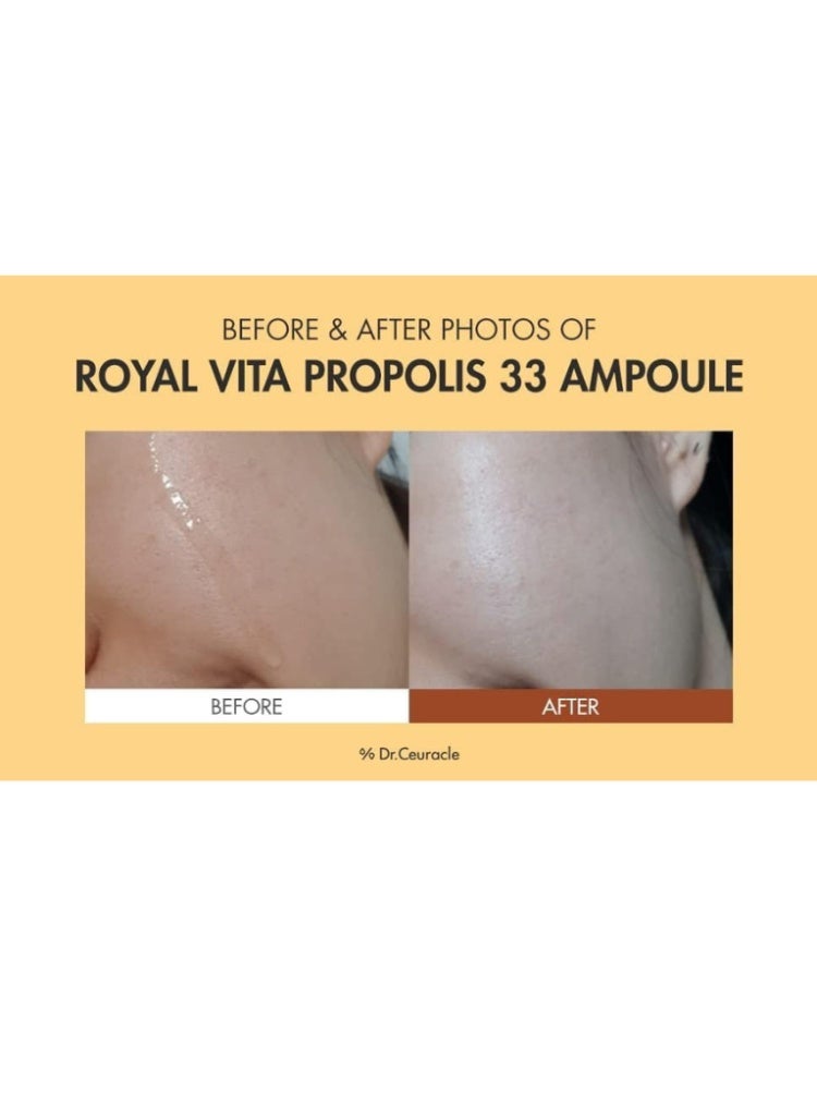 علاج البشرة الباهتة والجافة والمتعبة – Dr.Ceuracle Royal Vita Propolis 33 Ampoule لإشراقة فورية، ترطيب عميق وشد البشرة (30ml) - Image 3