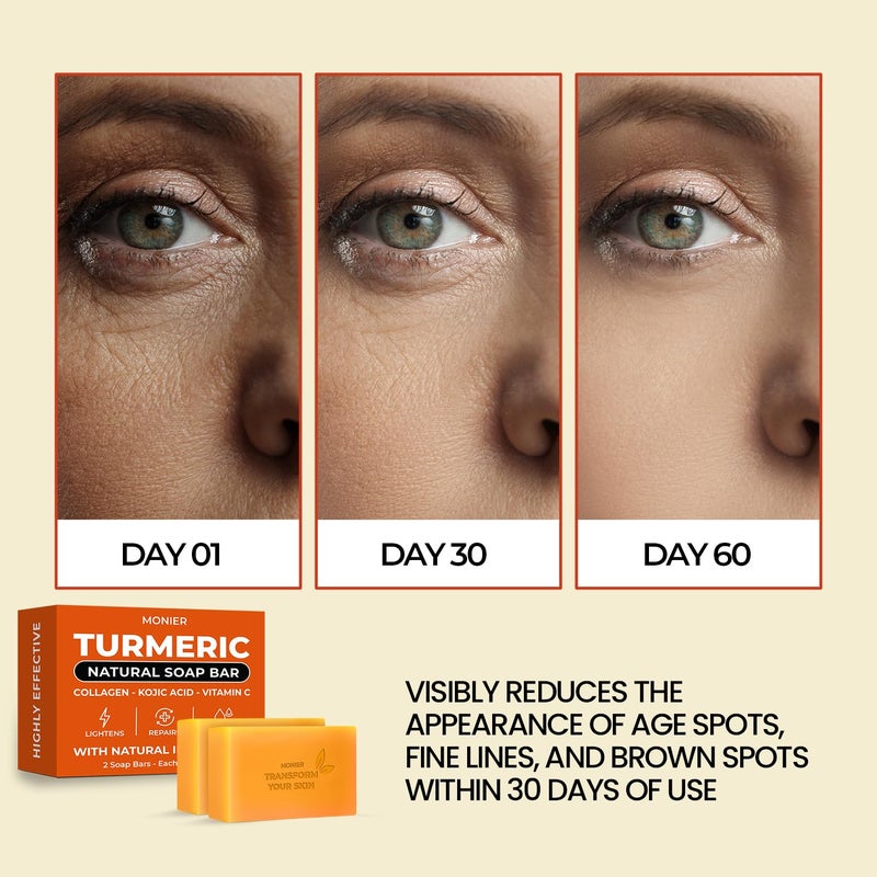 MONIER Turmeric Soap Bar for Dark Spots With Kojic Acid Collagen Coconut Oil Vitamin C Vitamin E Moisturizing Nourishing Vegan Natural 2 Soap Bars Storage Net - Image 2