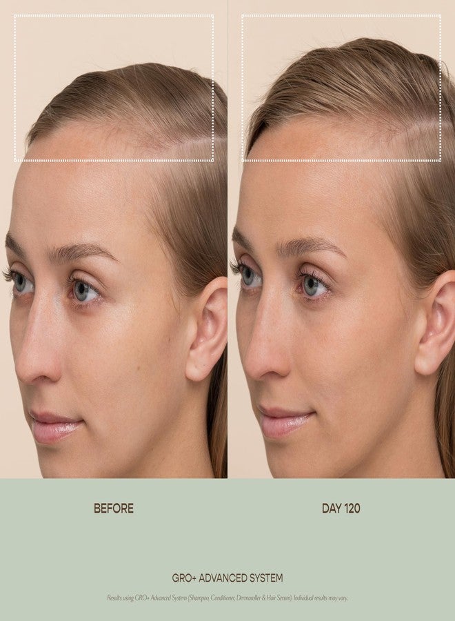 VEGAMOUR GRO+ Advanced Balancing Conditioner | Hydrates the Scalp, Nourishes and Softens Hair | For Severe Signs of Thinning | Color Safe, Vegan, Cruelty-Free, Formulated Without Silicones (8 Fl Oz) - Image 4