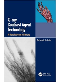 X-ray Contrast Agent Technology: A Revolutionary History  - Image 2