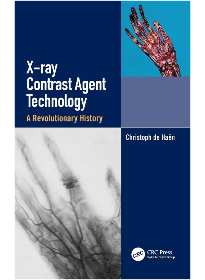 null - X-ray Contrast Agent Technology: A Revolutionary History - Image 1