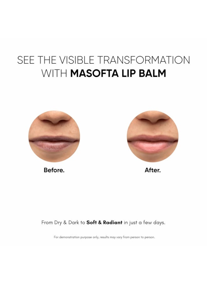 Masofta anti Pigmentation Lip Balm With Kojic Acid,Alpha Arbutin & Shea Butter For Smooth,Crack Free & Clear Lips,Spf 30 Pa++,15Gms,All - Image 5