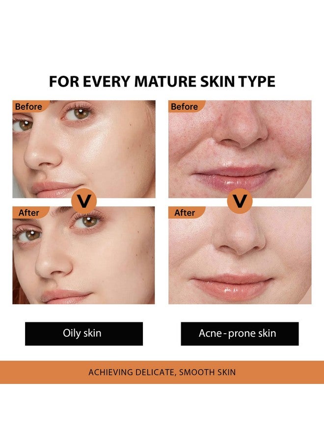 VGO Retinol Serum for Face - Anti-Aging & Hydration Powerhouse for a Firmer, Youthful Glow - Ideal for Acne-Prone & Oily Skin, Tightening & Moisturizing 50 ml / 1.69 Oz - Image 2