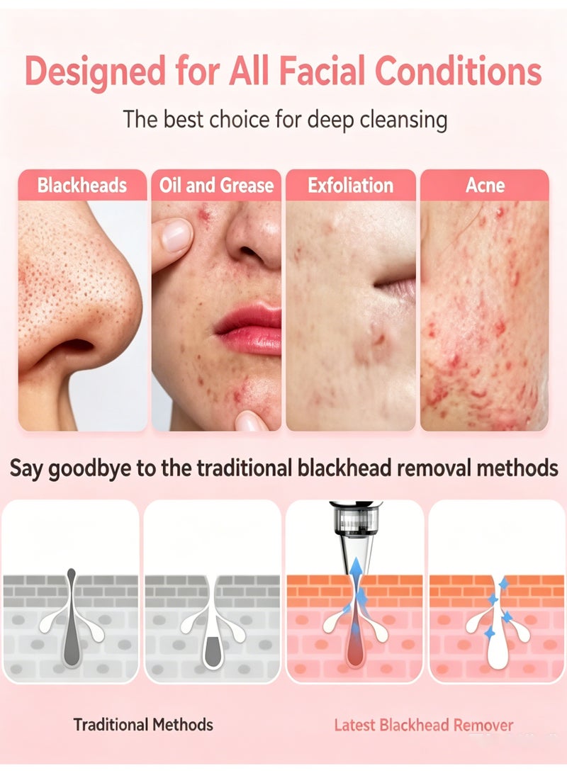 KIIUMI Blackhead Remover Pore Vacuum,Blackhead Vacuum,Facial Pore Cleaner with 5 Adjustable Suction Levels, 5 Probes, USB Rechargeable Pore Cleaner for Men&Women,Acne Extractor Remover Vacuum Cleaning Instrument - Image 4