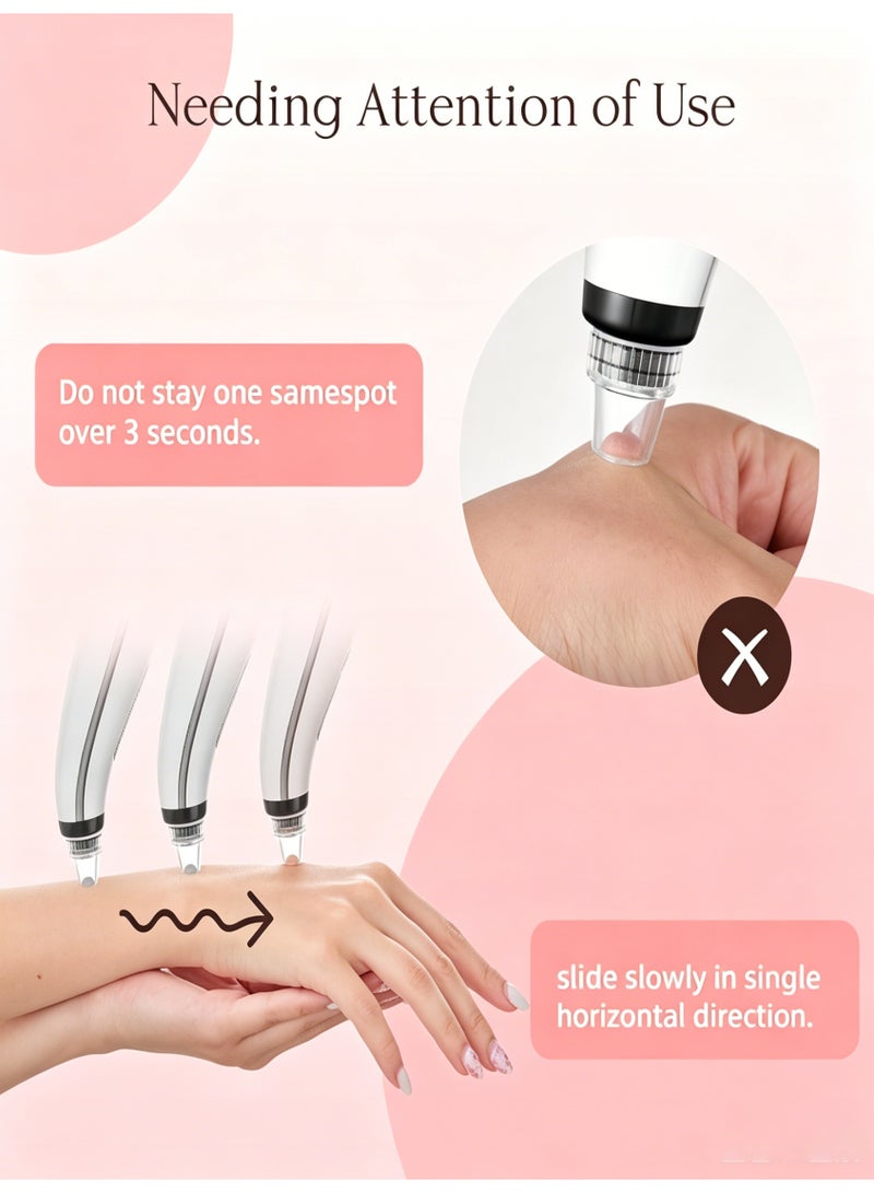 KIIUMI Blackhead Remover Pore Vacuum,Blackhead Vacuum,Facial Pore Cleaner with 5 Adjustable Suction Levels, 5 Probes, USB Rechargeable Pore Cleaner for Men&Women,Acne Extractor Remover Vacuum Cleaning Instrument - Image 2