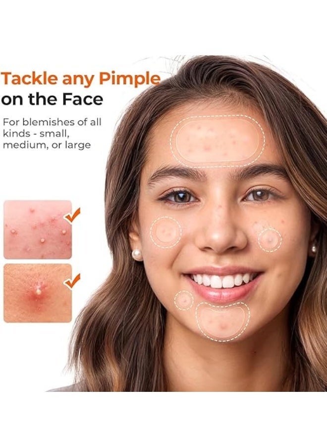 LA LUSH 443 Count Pimple Patches for Face, Hydrocolloid Acne Patch Bulk, Acne Stickers for Covering Cheeks, Forehead, Chin Blemishes Zit Breakouts for All Skin Types (Dots, Strip, Contoured 5 Sizes) - Image 4