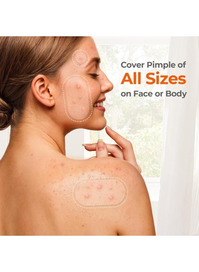 LA LUSH 443 Count Pimple Patches for Face, Hydrocolloid Acne Patch Bulk, Acne Stickers for Covering Cheeks, Forehead, Chin Blemishes Zit Breakouts for All Skin Types (Dots, Strip, Contoured 5 Sizes) - Image 5