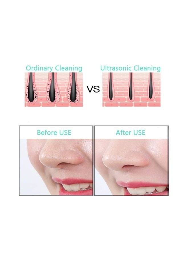Electric Facial Pore Cleaning Brush - Image 4