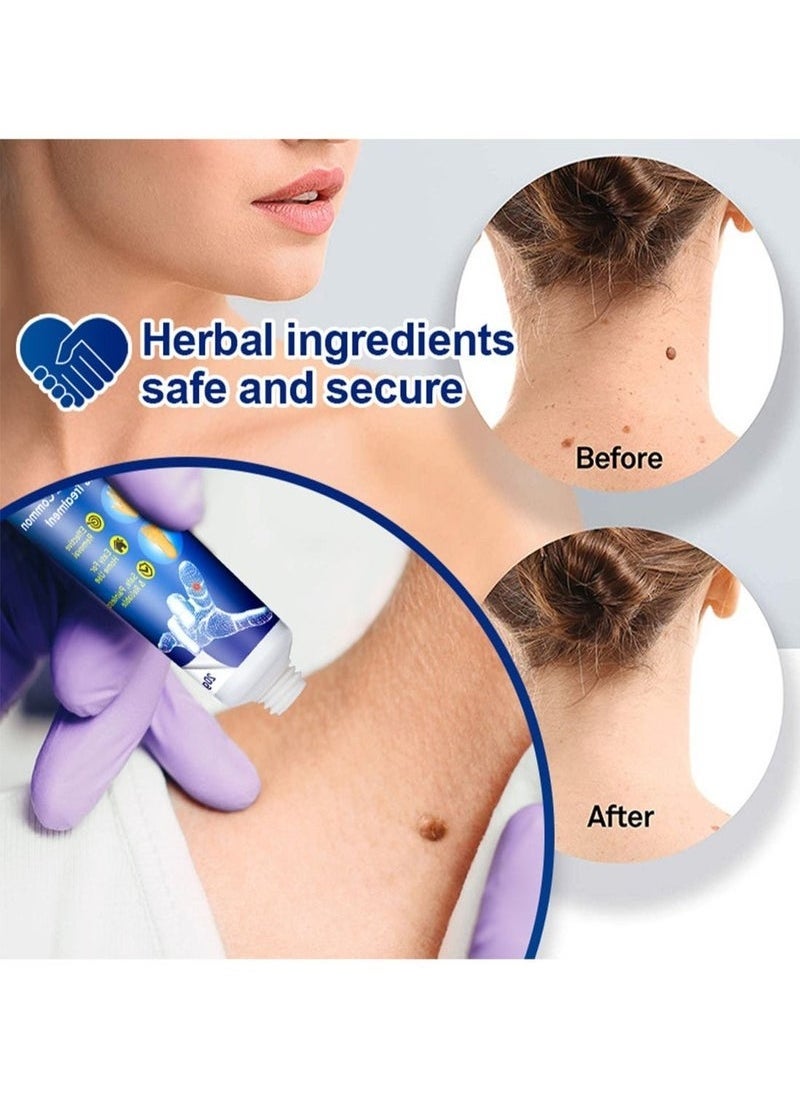Sumifun Wart Remover Ointment Cream Skin Treatment with Natural Herbal Ingredients for the Treatment of Common Warts Effective and Safe  - Image 3