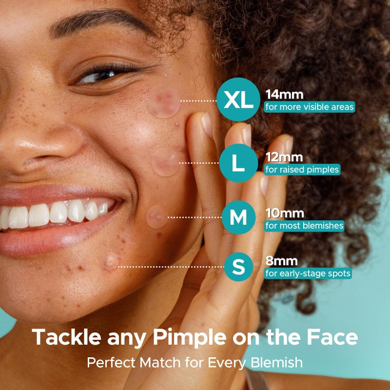 TKTK Hydrocolloid Acne Patches, Pimple Patches for Face with Tea Tree & Calendula Oil - 4 Sizes Clear Cover Stickers, Invisible for Day & Night Use (180 Count) - Image 3