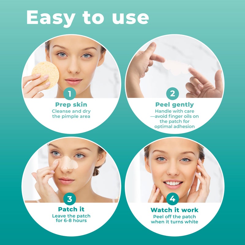 PatchRx Pimple Patches for Nose (12 Pack), Cover Nose Pimples - Hydrocolloid Acne Patches - Pimple Patch Hydrocolloid Patches & Pimple Stickers, Nose Strip, Zit Patches - Image 4