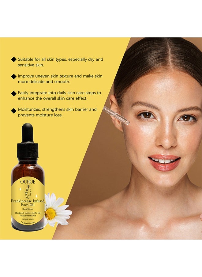 OUHOE - Frankincense Infused Face Oil,Frankincense Resin Infused Oil For Face,Organic Black Seed Castor & Jojoba Oils,Frankincense Resin Oil Essential,Cold Pressed Serum Anti-Aging Wrinkle 30ml - Image 1