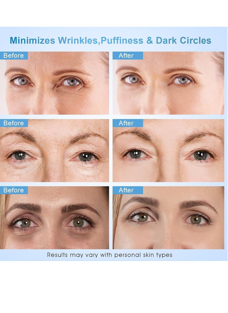 Dongyu - Dongyu Anti-Aging Eye Cream for Wrinkles: Under Eye Cream with Snail Mucin Caffeine for Fine Lines Puffiness - Firming Eye Serum for Women - Image 1
