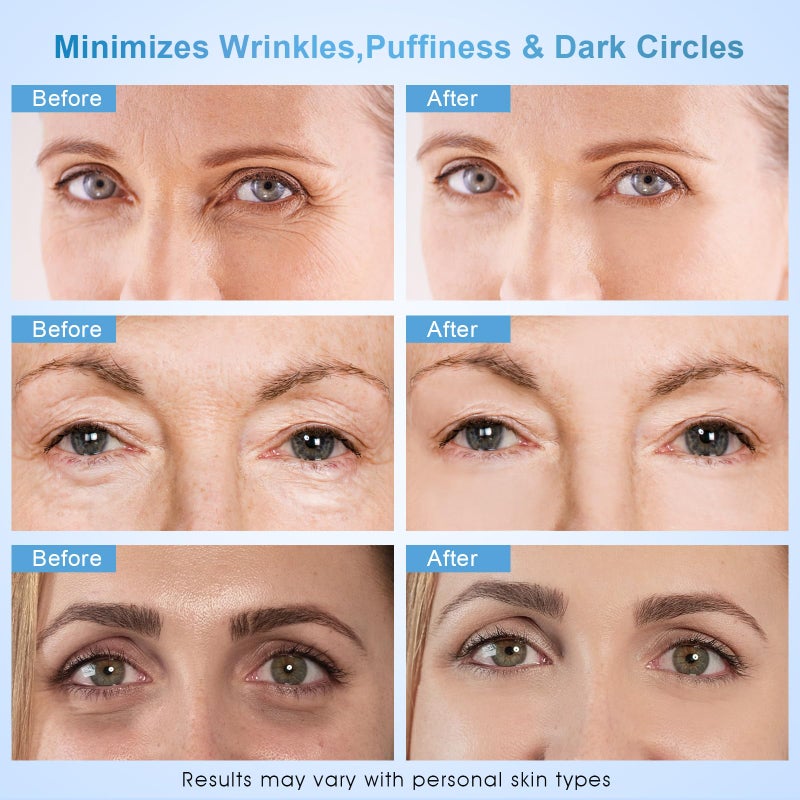 Dongyu Anti-Aging Eye Cream for Wrinkles: Under Eye Cream with Snail Mucin Caffeine for Fine Lines Puffiness - Firming Eye Serum for Women - Image 3