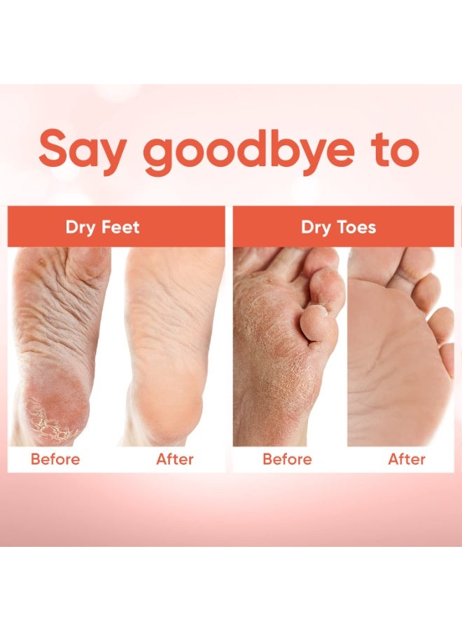 CELOR Foot Peel Mask - Foot Mask for Baby Soft Skin - Remove Dead Skin, Dry, Cracked Feet & Callus, Foot Spa, Made with Aloe Vera Extract for Women and Men (2 Pairs Peach)  - Image 3