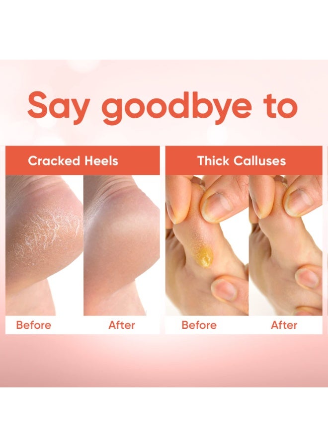 CELOR Foot Peel Mask - Foot Mask for Baby Soft Skin - Remove Dead Skin, Dry, Cracked Feet & Callus, Foot Spa, Made with Aloe Vera Extract for Women and Men (2 Pairs Peach)  - Image 5