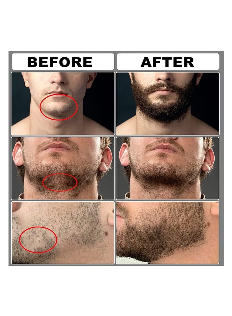 RedMapleTEK Beard Serum Beard Balm Beard Roller Set Beard Care 4-piece Set - Image 5