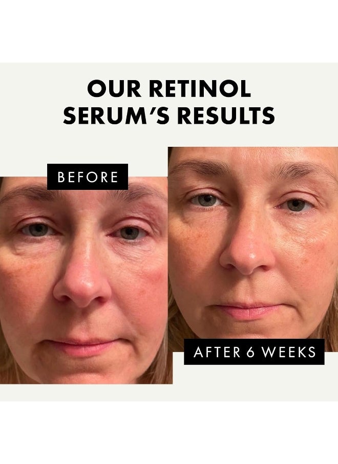 Eclat Skincare Pure Retinol Serum (2.5%) For Face/Neck/Eyes - 5X More Powerful Cold Processed Anti-Ageing Serum With Pure Vitamin A - Reduces Wrinkles/Lines/Aging - Vegan/Dermatologist Developed  - Image 3