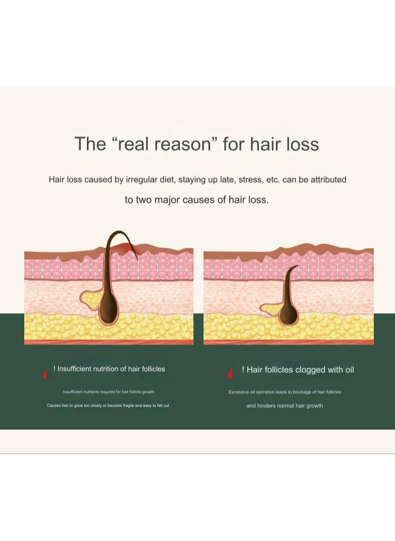 RUKYU - Polygonum multiflorum anti-hair loss and hair growth shampoo anti-dandruff and anti-itching ginseng fluffy oil control anti-hair loss shampoo - Image 1
