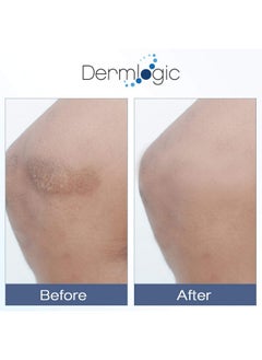 Dermlogic Vitamin K Cream- Moisturizing Bruise Healing Formula. Dark Spot Corrector for Bruising, Spider Veins & Broken Capillaries. Reduces Under Eye Dark Circles, Fine Lines, Puffiness, & Wrinkles with Arnica  - Image 4