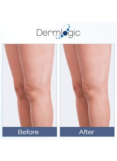 Dermlogic Vitamin K Cream- Moisturizing Bruise Healing Formula. Dark Spot Corrector for Bruising, Spider Veins & Broken Capillaries. Reduces Under Eye Dark Circles, Fine Lines, Puffiness, & Wrinkles with Arnica  - Image 3
