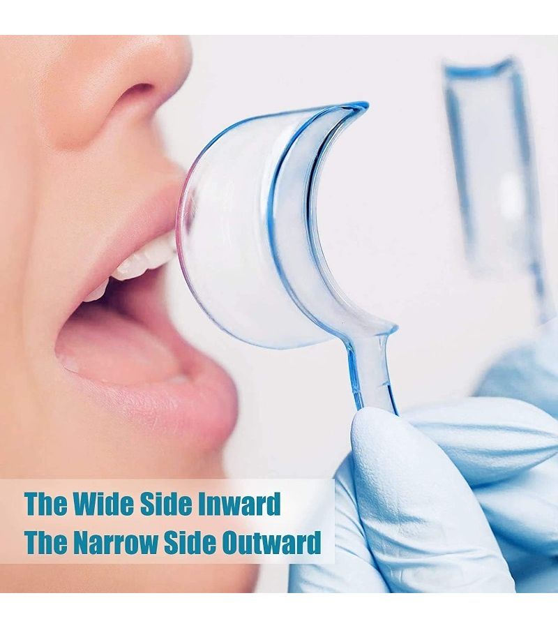 Type C Mouth Opener Dental Cleaning Tool Transparent Plastic Mouth Holder 6 Piece Set Large Medium And Small - Image 4