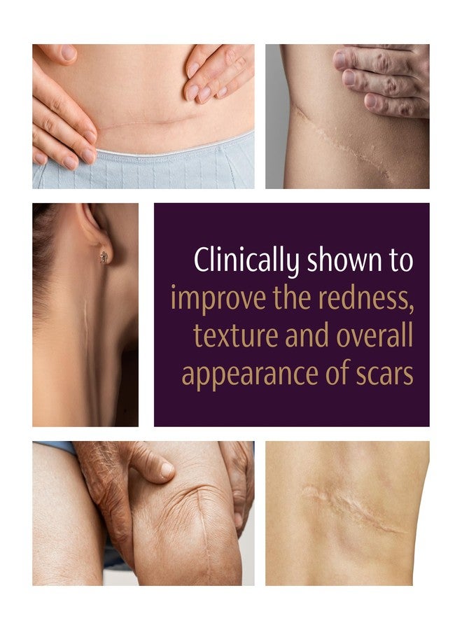 Mederma Advanced Scar Gel 1x Daily Reduces The Appearance of Old New Scars #1 Doctor Pharmacist Recommended Brand for Scars 1.76oz, Clear, 100g (2x50g) - Image 5