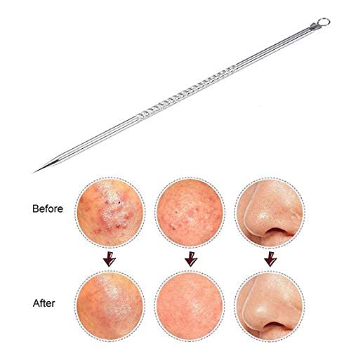 CHEM-AB ENTEREPIRSE CHEMAB ENTEREPIRSE Stainless Steel Blackhead Remover Needle Round And Pointed Tip Set of 2 Pcs - Image 4