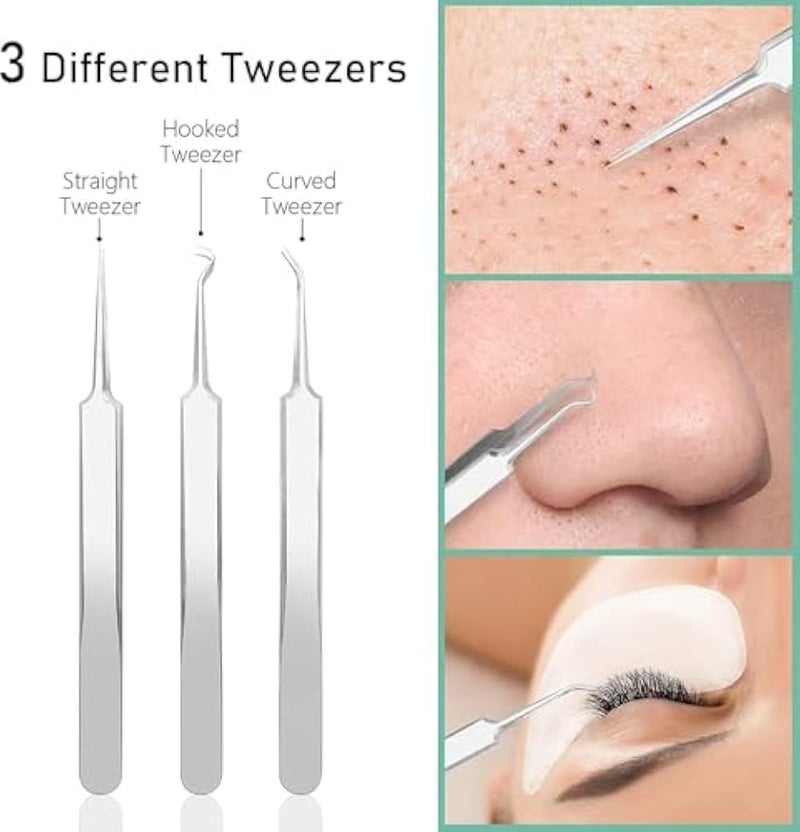 8 Pcs Blackhead Remover Tool Kit with Metal Case, Acne Comedone Clip Blackhead Tweezer for Ingrown Hair Removal - Image 3