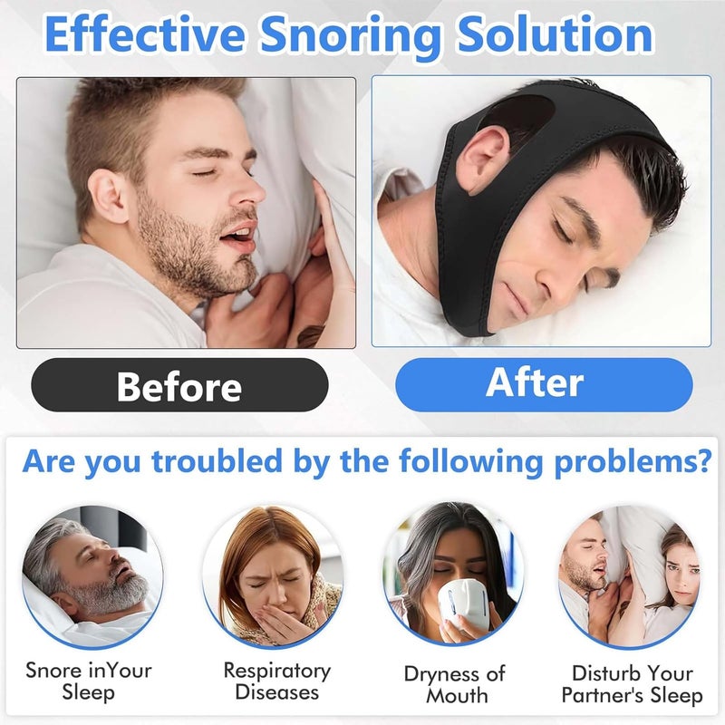 CoolShef حزام الذقن للنوم - أجهزة مريحة مضادة للشخير للنساء والرجال | شريط فم قابل للتعديل للنوم | حل لإيقاف الشخير والتنفس من الفم لنوم أفضل - Image 3