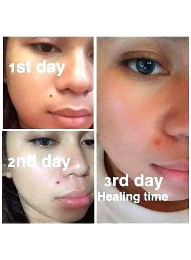 ANGEL TOUCH Kasoy Cream Skin Care Solution — A Convenient Topical Cream Advertised for Supporting Care of Common Skin Concerns Such as Ringworm, Fungal Irritations, Milia, Warts, Skin Tags, Keloids, and Dermatitis with Regular Application. - Image 1