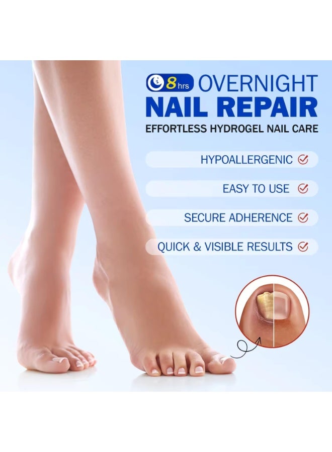 Elaimei 21Pcs Fungal Nail Patch Nail Treatment Renews Nails Structure and Improve Discoloration Overnight Nail Repair Patch for Nail Fungus Damage 8Hrs Nighttime Renewal Fungal Nail Patches - Image 2