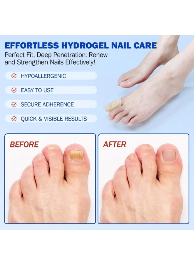 Elaimei 21Pcs Fungal Nail Patch Nail Treatment Renews Nails Structure and Improve Discoloration Overnight Nail Repair Patch for Nail Fungus Damage 8Hrs Nighttime Renewal Fungal Nail Patches - Image 5