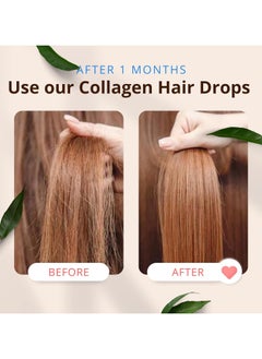 MORFOSE Morfose Hair Strengthening Drops - Collagen Infused (100ml)  - Image 4