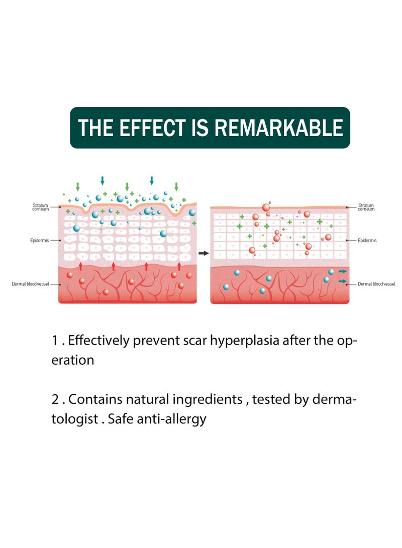 EELHOE 4cm*1.5m Fade Scar Sticker Efficient Beauty Scars Removal Silicone Gel Skin Tone Self-adhesive Acne Burn Repair Patch - Image 5