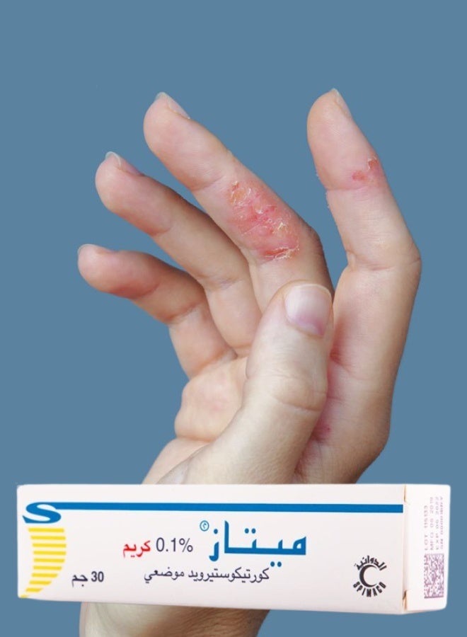 ميتاز 12 قطع ميتاز 1 مجم كريم 30جرام - Image 2