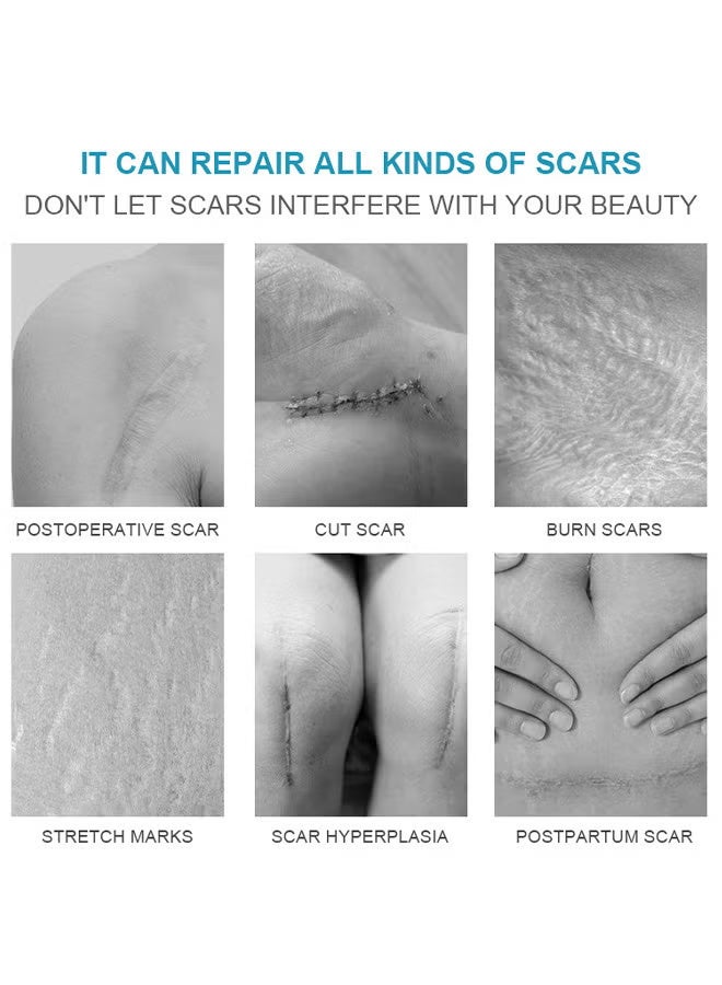 LANEMAY Scar Cream, Medical Grade Silicone Scar Cream Advanced Scar Removal Gel For Surgical Scars Stretch Marks Acne Injury Burns Keloids Hypertrophic Old And New Scars 20G - Image 5