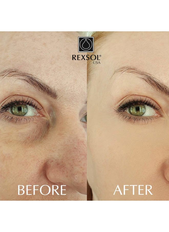 REXSOL - Retinol + Vitamin C Anti-Aging Cream | Effective Night Face Care & Dark Spot Remover | Anti-Aging Neck Cream & Wrinkle Cream That Truly Works | Infused with Vitamin E, A - 2 OZ - Image 1