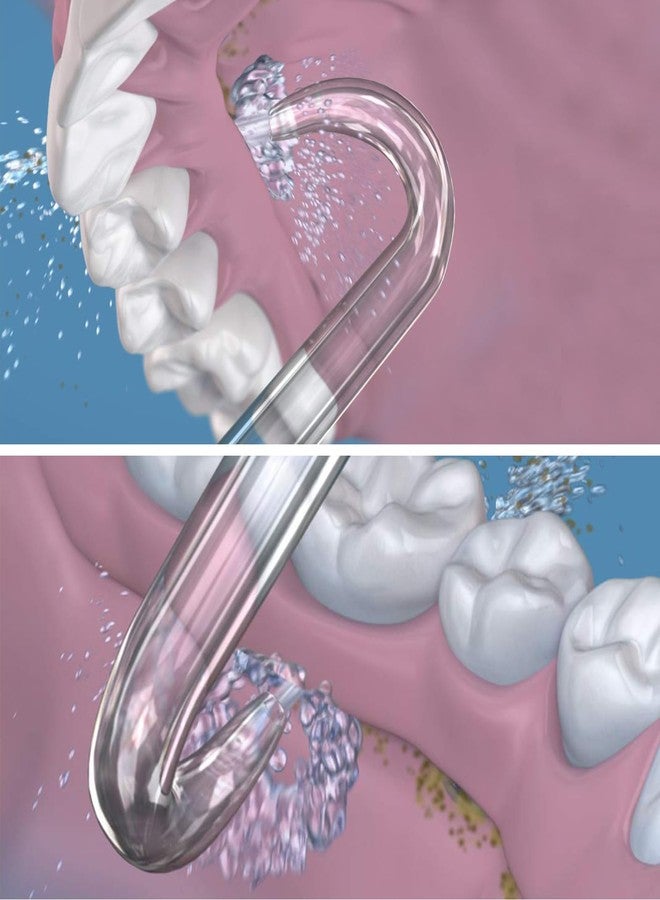 RAXSEG Professional Replacement Tips for Waterpik Water Flosser - 6 Implant Denture Tips - Image 3
