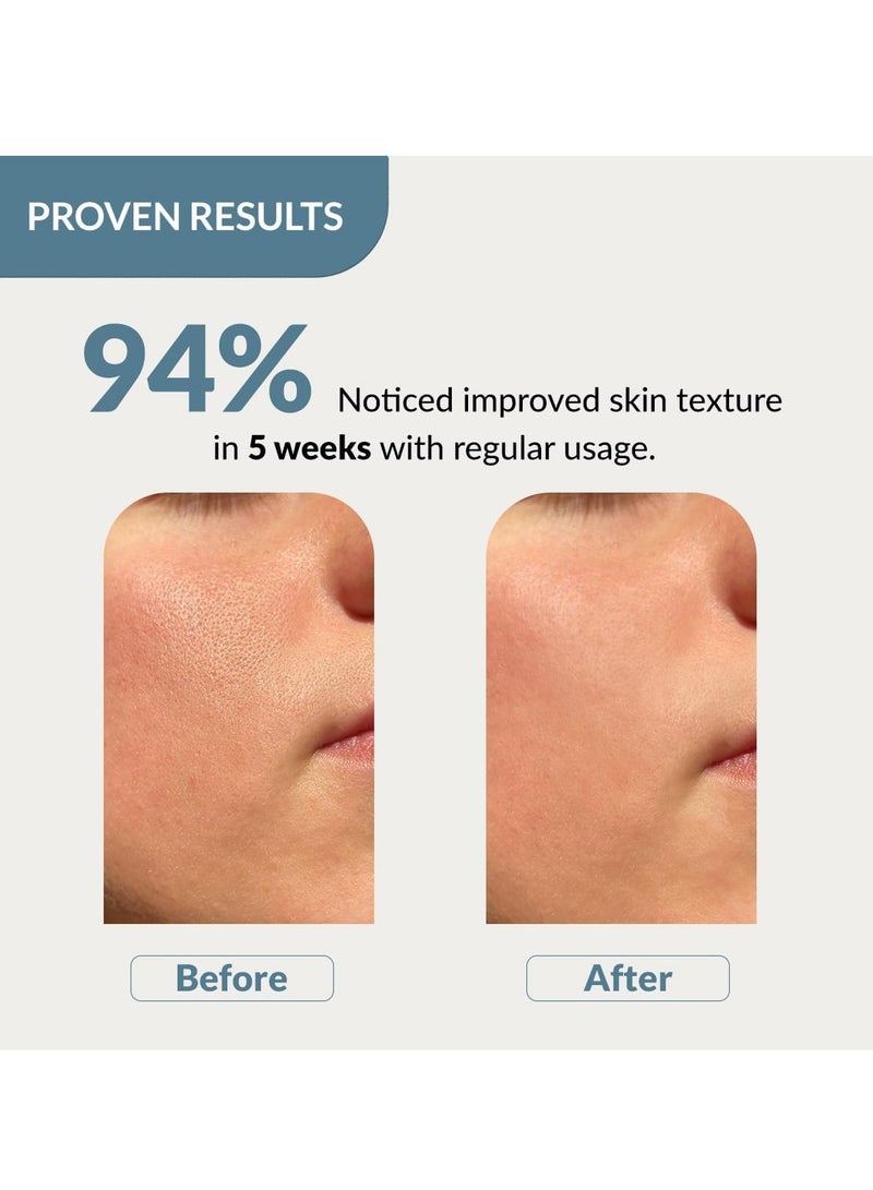 فيكسديرما مصل فيكسديرما 20% نياسيناميد للوجه لتقليل المسام مع 2.5% جلوكوزامين ومصل حمض الهيالورونيك | سيروم المسام المفتوحة | مصل الترطيب | مصل الوجه للرجال والنساء - 30 جم - Image 3