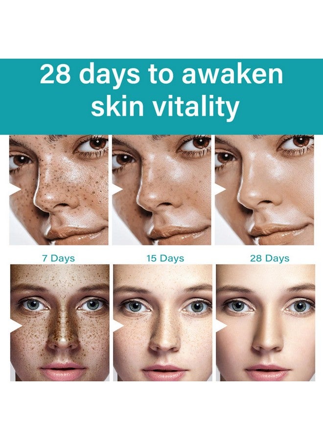 بامينفي مزيل البقع الداكنة للوجه والجسم، كريم إزالة النمش بالنيكوتيناميد، مصحح البقع الداكنة المضاد للشيخوخة للبقع العمرية، والبقع الشمسية، وفرط التصبغ، والكلف، مرطب ولطيف على البشرة، 1 أونصة - Image 2