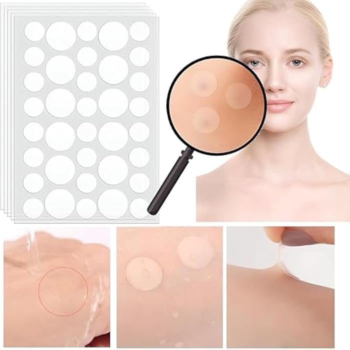 Acne Treatment Patch 💛😺️ We Apply to Pimples for 8 Hours to Dry Effectively ❤️ Quickly Absorb Bacteria in Pimples and Prevent Scars ❤️ Stay Put Even With Water Exposure.(24 Sticks) - Image 3